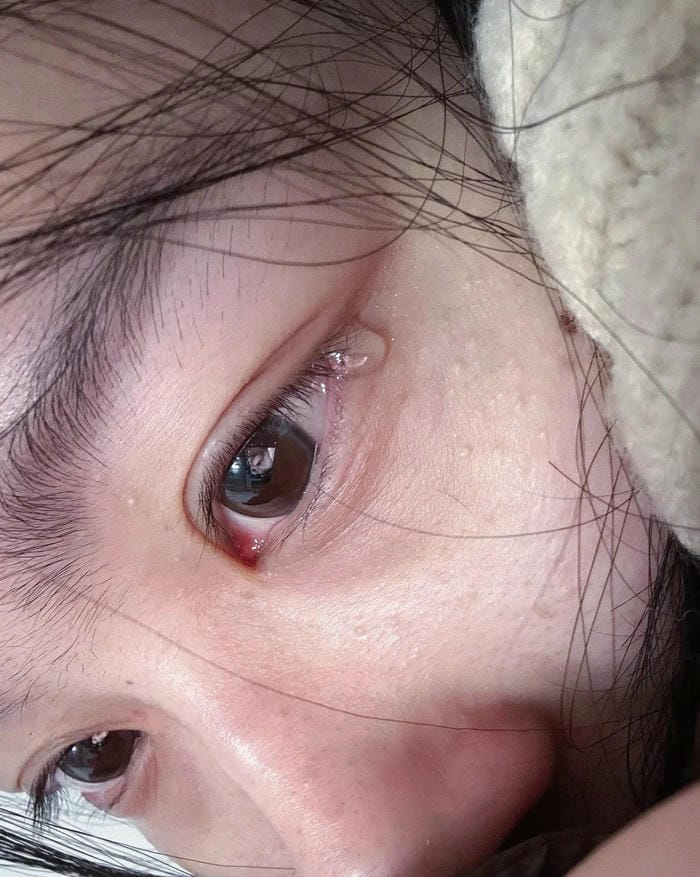 ảnh buồn tâm trạng con gái mang tâm trạng thấp